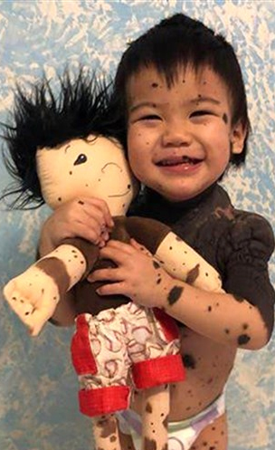 Dolls Like Me Makes Toys for Kids with Differences